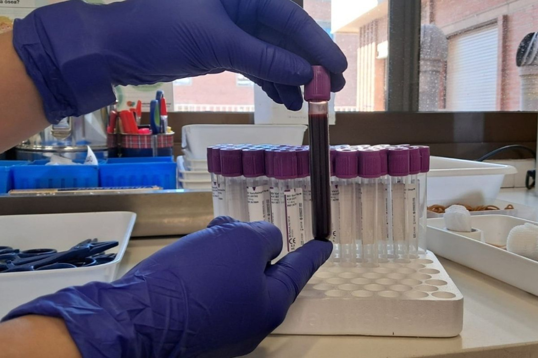 Muestra de sangre en un laboratorio